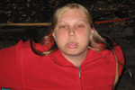 Reske